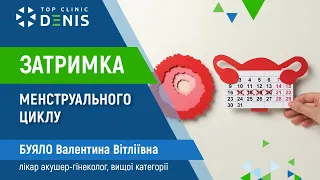 Затримка менструального циклу у підлітків - дитячий гінеколог вищої категорії | TOP Clinic DENIS