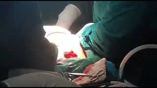 cesarean-section