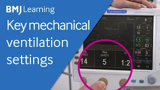 Key settings for a mechanical ventilator | BMJ Learning
