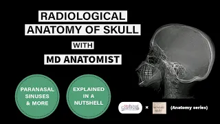 Radiological Anatomy-Skull and Paranasal Sinuses| SIMPLIFIED!