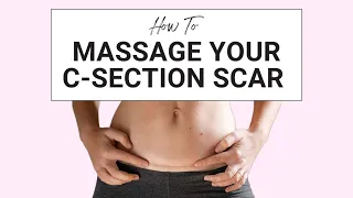 How to Massage Your C-Section Scar
