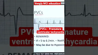 PVCs - Premature ventricular tachycardia #nclex #nursing #voogly #offline