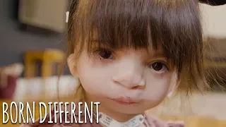 Nova: Our Girl With A Mystery Condition | BORN DIFFERENT
