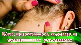 ➤ Как вытащить клеща в домашних условиях. ➤