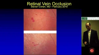 Retinal Vein Occlusion