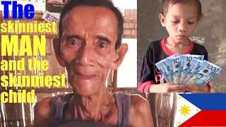 Revisiting the Skinniest Filipino Man and the Skinniest Filipino Child in the Philippines. POVERTY