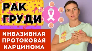 Рак груди. ИНВАЗИВНАЯ ПРОТОКОВАЯ карцинома молочной железы. РМЖ симптомы, диагностика, лечение. Виды