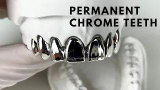 Permanent Chrome Teeth