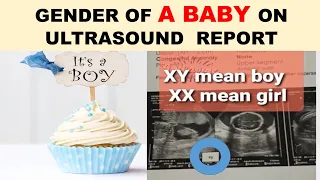 baby girl or boy ? ultrasound report per baby ki gender kahan mention hoti hae ?