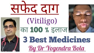 Vitiligo { Safed Daag } ka Best treatment | Tacrolimus ointment , Femcort cream , Pigmento ointment