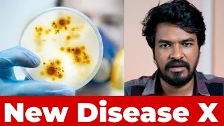 🦠 Disease X 2023 Explained ⚠️ | Madan Gowri | Latest News Tamil