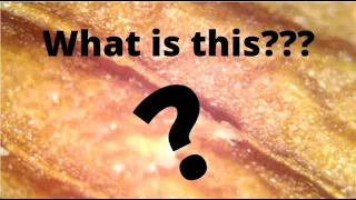 Can You Guess What's Under the Microscope? Episode 1