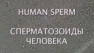 Human sperm - Сперматозоиды человека