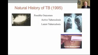 TB Elimination: Why Not Now? Session 2