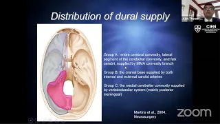 27. Evaluation and Management of Dural Arteriovenous Fistulas by Dr. Ajith Thomas