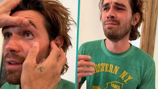 KJ Apa Cries After Taking Metal Shard Out From Eye