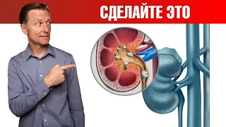 Первые признаки камней в почках🙌Что делать?