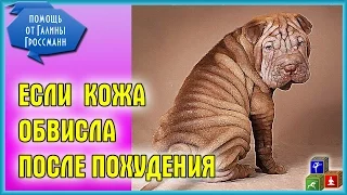 ✚✚ Обвисшая кожа после похудения - как ее подтянуть?