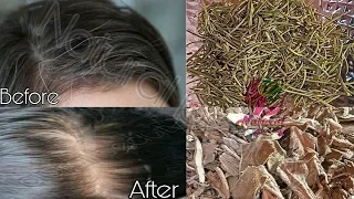 Treating gray hair naturally in just 5 minutes! 100% tested and effective