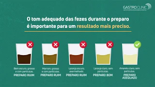 COLONOSCOPIA - Preparo e Orientação com Manitol