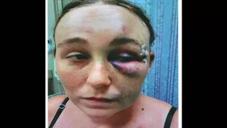 Days after testifying against police officer, woman says deputies beat her