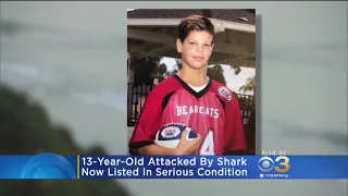 Teenager In Serious Condition After Shark Attack In Southern California