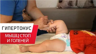 ГИПЕРТОНУС МЫШЦ СТОП И ГОЛЕНЕЙ У РЕБЕНКА ДО ГОДА