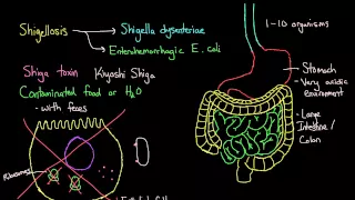 What is shigellosis? | Gastrointestinal system diseases | NCLEX-RN | Khan Academy