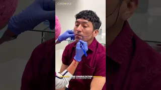 Beard Transplant: This is the procedure 😎 | Care4Hair