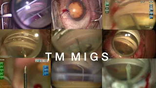 MicroInvasive Glaucoma Surgery Algorithm Lecture Ike Ahmed 2022