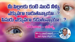 stickyeyes in babies || watery eyes in babies || Dr Madan Kumar cv