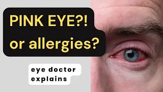 Eye Allergies vs Conjunctivitis | allergy eyes vs pink eye | allergic conjunctivitis |