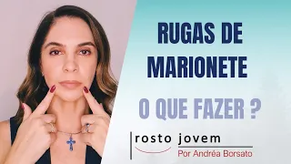 RUGAS DE MARIONETE, O QUE FAZER ?