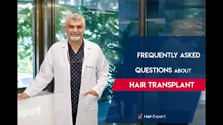 Frequently Asked Questions about Hair Transplant