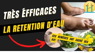 Comment soigner la rétention d'eau/œdème/jambe lourde naturellement avec les plantes✅