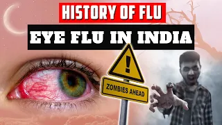 Eye Flu : Conjunctivitis यानी Eye Flu क्या होता है? History of influenzas