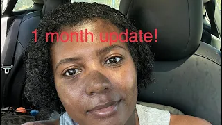 Ethnic Rhinoplasty 1 Month Update!