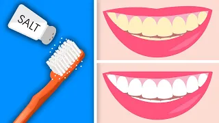 Turn Your Yellow Teeth Pearly White (2 Minutes)