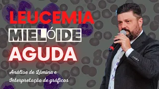 Leucemia Mieloide Aguda - Leitura de Lâmina e Interpretação de Gráficos