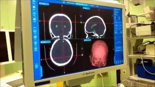 Мы внедрили систему хирургической навигации