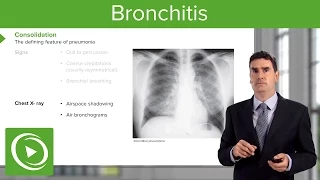 Bronchitis: Consequences, Symptoms & Treatment – Respiratory Medicine | Lecturio