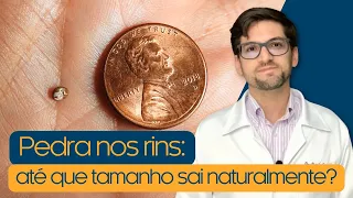 Pedra nos rins: até que tamanho elas descem naturalmente?