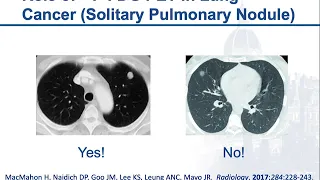 When, and When Not, to Use PET/CT Part 1