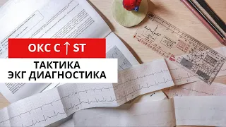 Инфаркт миокарда с подъемом сегмента ST.  ЭКГ диагностика. Тактика. Часть 2.