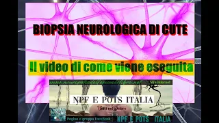 Biopsia neurologica di cute, il video di come viene eseguita