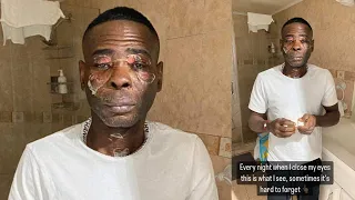 Rigondeaux Shares Photo After Pressure Cooker Explodes In His Face |