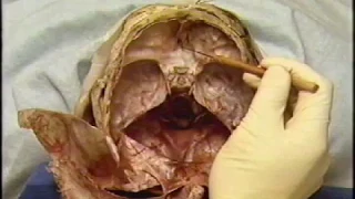 Forensic Medicine: Human Head and Neck Dissection Explained in Details Part-2