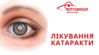 Лікування катаракти. Центр Зору ОПТИМАЛ м. Вінниця