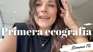 Vlog - VEMOS A NUESTRO BEBÉ por primera vez. Primera ECOGRAFÍA SEMANA 12 🤰