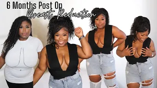 😍 6 MONTHS POST OP| BREAST REDUCTION | THE NEW GIRLSSS LOOK SO GOOD!!